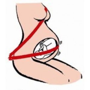 Afbeelding van Besafe - Zwangerschapsgordel voor in de Auto Pregnant Izi fix